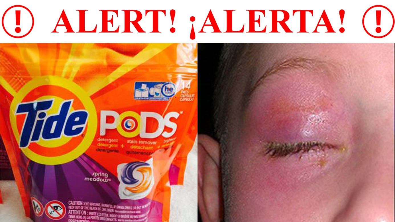 alert-tide-pods-poisonings-on-the-rise-moore-law-firm